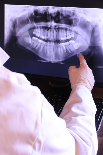 Best Emergency Dental Care for Abscessed Tooth in Burlington, IA