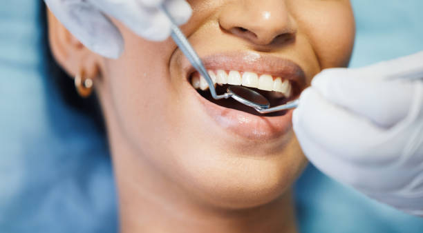 Best Emergency Cosmetic Dentistry in Burlington, IA