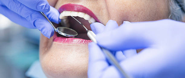Best Emergency Root Canal Treatment in Burlington, IA